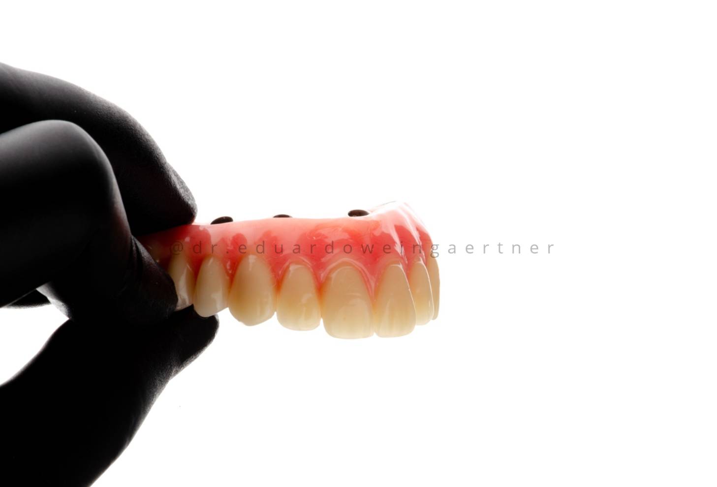 Prótese Protocolo sobre Implantes